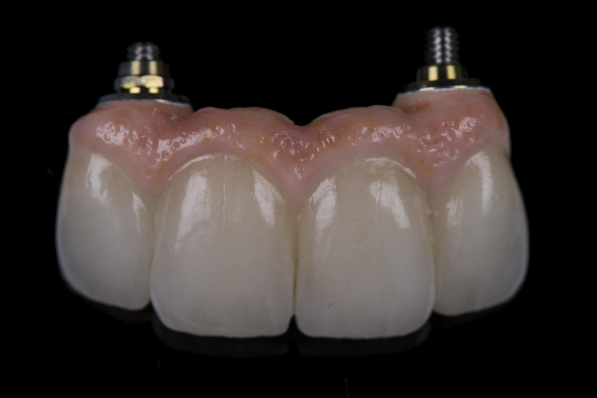 Pink Esthetics Kwalident Dental Studio